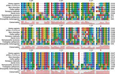 Functional Classification of the ATM Variant c.7157C>A and In Vitro Effects of Dexamethasone